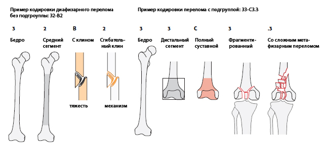 Перелом большеберцовой кости карта вызова