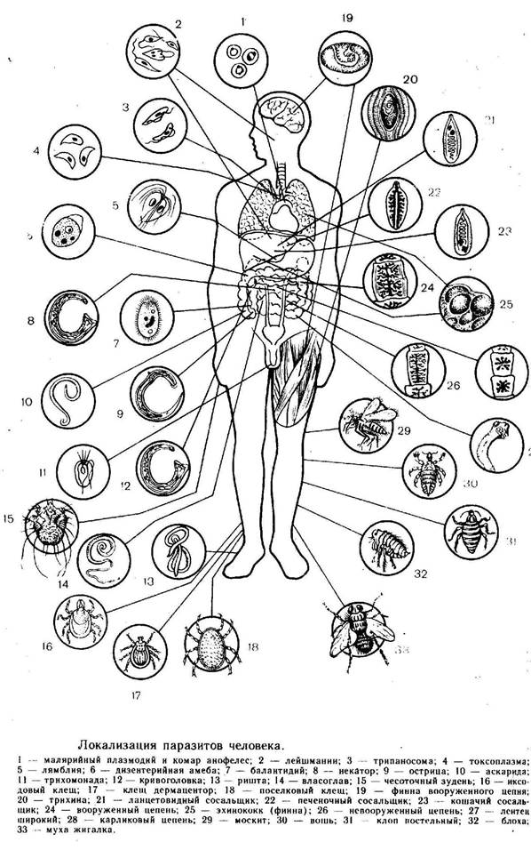 Строение внутренних паразитов. Схема локализации паразитов в организме человека. Локализация паразитов человека. Локализация паразитических простейших в организме человека. Паразиты на схеме тела человека.