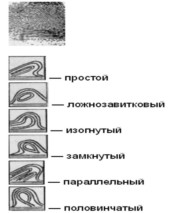 В коже пальца рисунок папиллярных линий определяется гистология