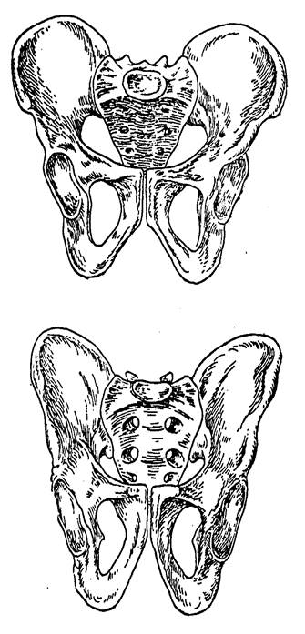 Расширение таза мужчин. Мужской и женский таз. Женский таз. Разница мужского и женского таза. Кости таза мужчины и женщины.