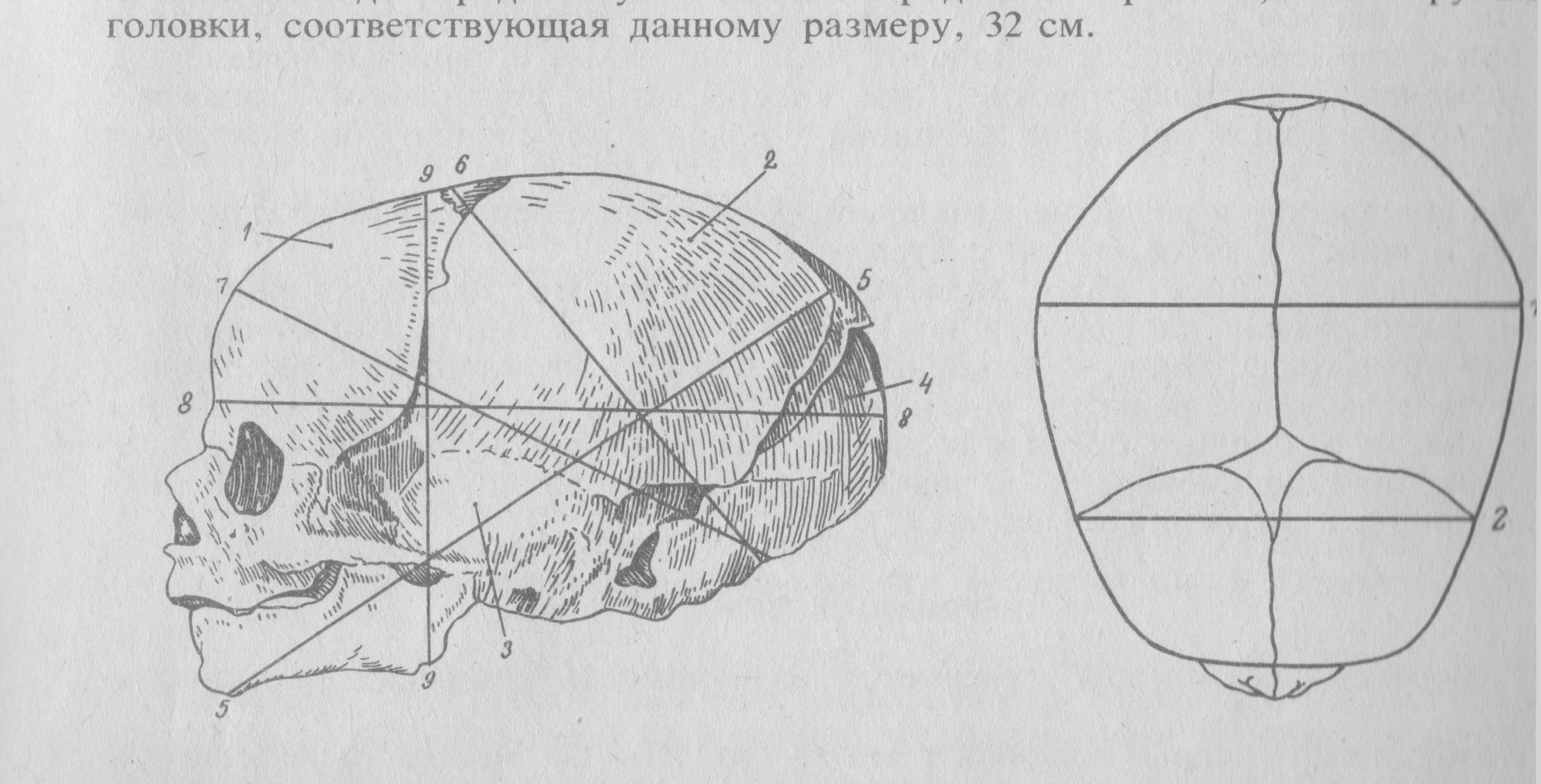 Окружность головы доношенного. Череп новорожденного вид сбоку Размеры. Череп новорожденного роднички Размеры головки новорожденного. Размеры головки плода. Швы и роднички головки плода.