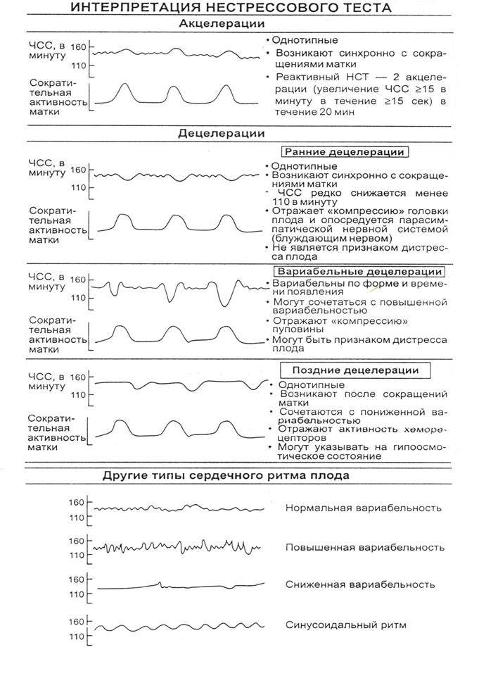 Нестрессовый тест положительный. Синусоидный ритм КТГ плода. Кардиотокография нестрессовый тест. КТГ плода расшифровка акцелерации и децелерации. Синусоидальный Тип КТГ.