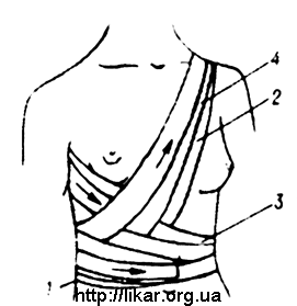 Повязка на молочные железы алгоритм. Поддерживающая повязка на правую молочную железу. Наложите бинтовую повязку на молочную железу.. Поддерживающая повязка на молочную железу алгоритм. Бинтовая повязка поддерживающая на молочную железу.
