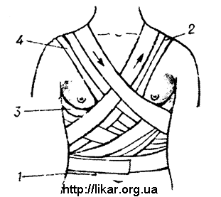 Повязка на молочные железы алгоритм. Лейкопластырная повязка на молочную железу. Наложите бинтовую повязку на молочную железу.. Наложение бинтовой повязки на молочную железу. Поддерживающая повязка на правую молочную железу.