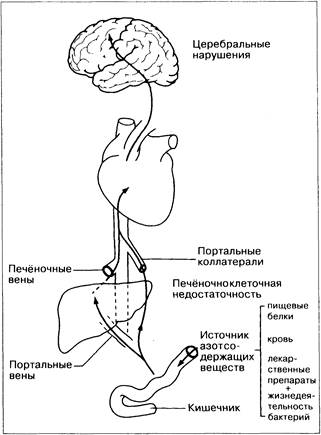 Патогенез печеночной энцефалопатии схема