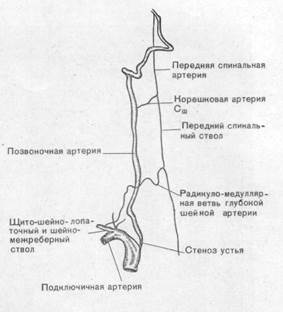 Сегменты подключичной артерии схема