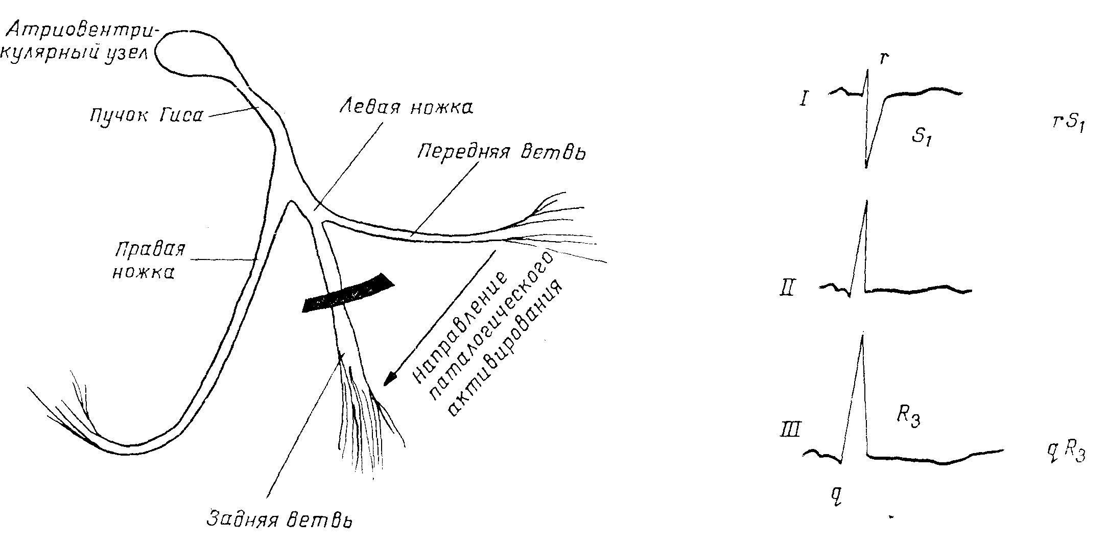 Правая и левая ножка пучка гиса