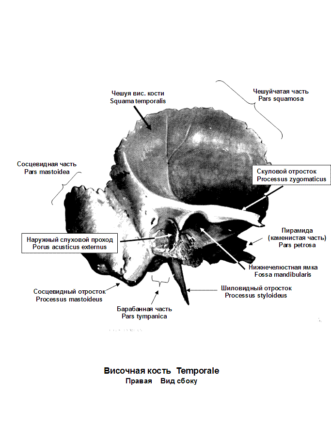 Теменная и височная кости тип соединения. Сосцевидный отросток височной кости черепа анатомия. Тип сосцевидного отростка височной кости. Основание сосцевидного отростка анатомия. Гипоплазия мыщелка затылочной кости.