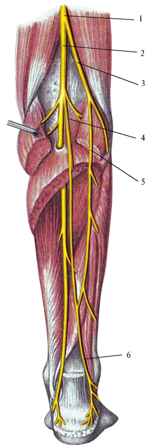 N suralis. Большеберцовый и малоберцовый нерв. Малоберцовый нерв анатомия. Cutaneus surae medialis. Малоберцовый нерв иннервация кожи.