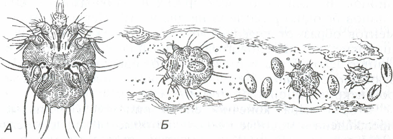 Цикл развития чесоточного клеща. Чесоточный клещ строение. Чесоточный зудень жизненный цикл. Цикл развития чесоточного зудня.