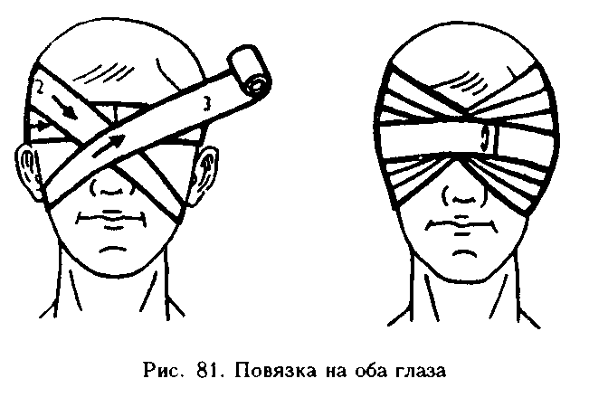 Как нарисовать повязку на глаза