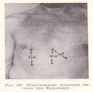 Селезенка по курлову