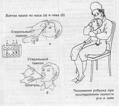 Зев носа. Взятие мазка из зева и носа. Техника взятия мазка из зева и носа. Взятие мазка из зева у детей. Мазок из зева и носа у детей.