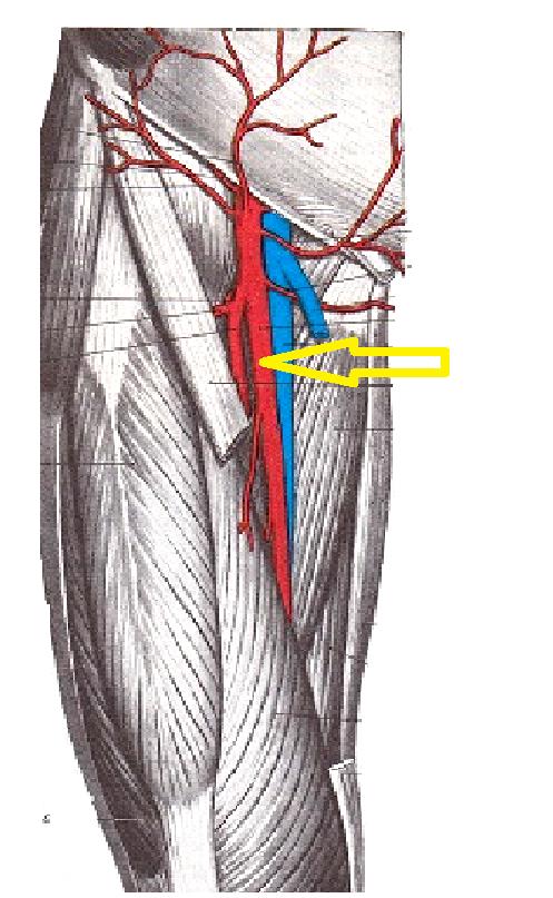Вена в паху у мужчин. Бедренная артерия Вена нерв. Бедренная артерия и Вена анатомия. Паховая подвздошная Вена. Топография бедренной вены.