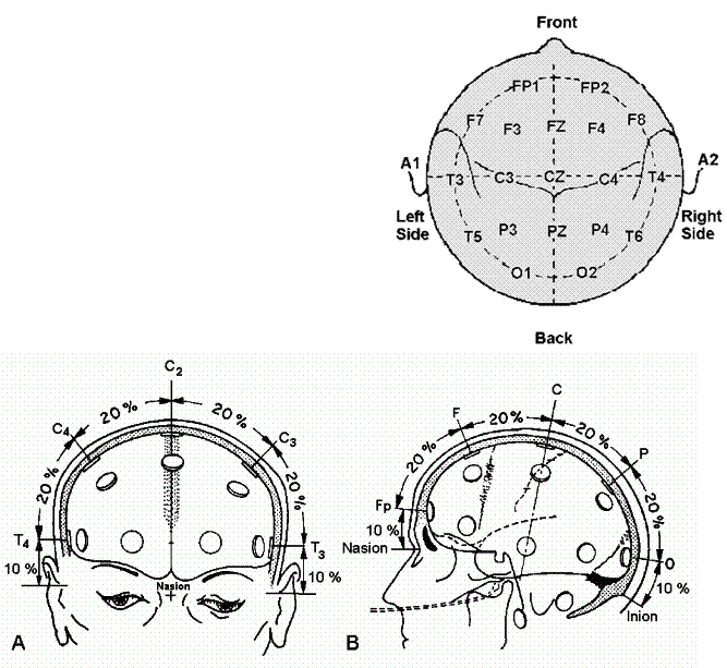 Ээг 10 10. Схема ЭЭГ 10-20. Схема наложения электродов при ЭЭГ. ЭЭГ головного мозга наложение электродов. Схема расположения электродов при ЭЭГ 10-20.