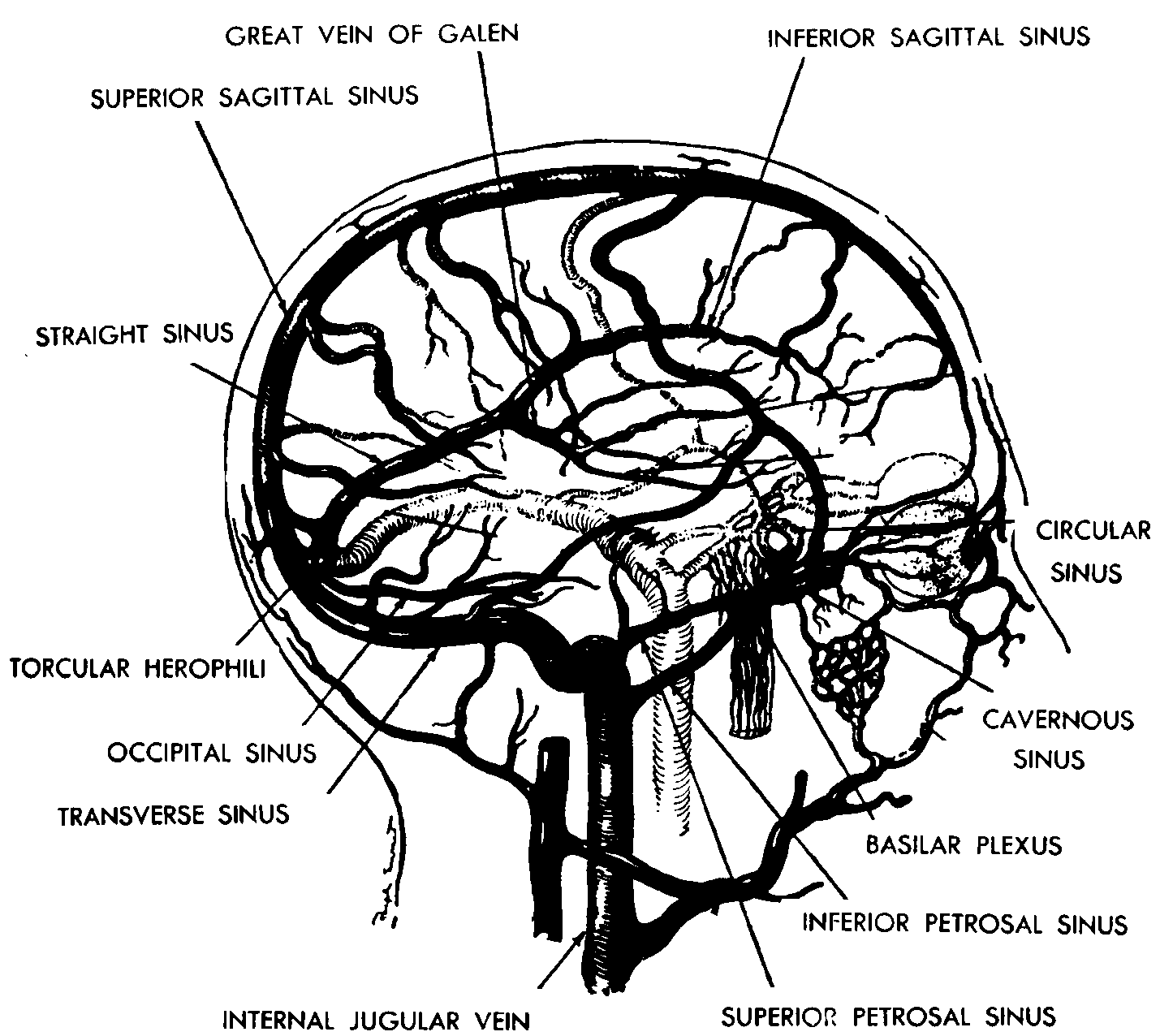 Синус оболочки мозга. Верхний Сагиттальный синус твердой мозговой. Вены синусы твердой мозговой оболочки. Синусы твердой оболочки головного мозга схема. Синусы твёрдой мозговой оболочки анатомия.