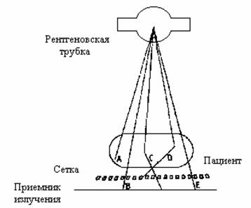 Приемник рентгеновского изображения