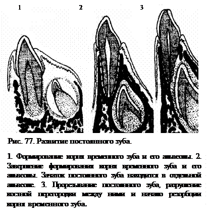 Замещающие зубы