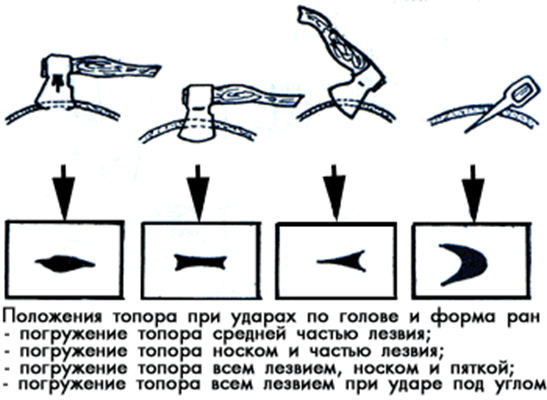 Колото резаные раны механизм образования.