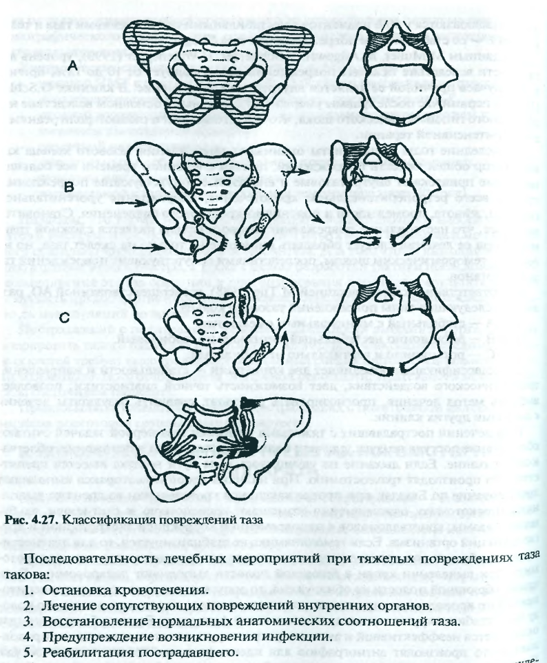 Изменения костей таза