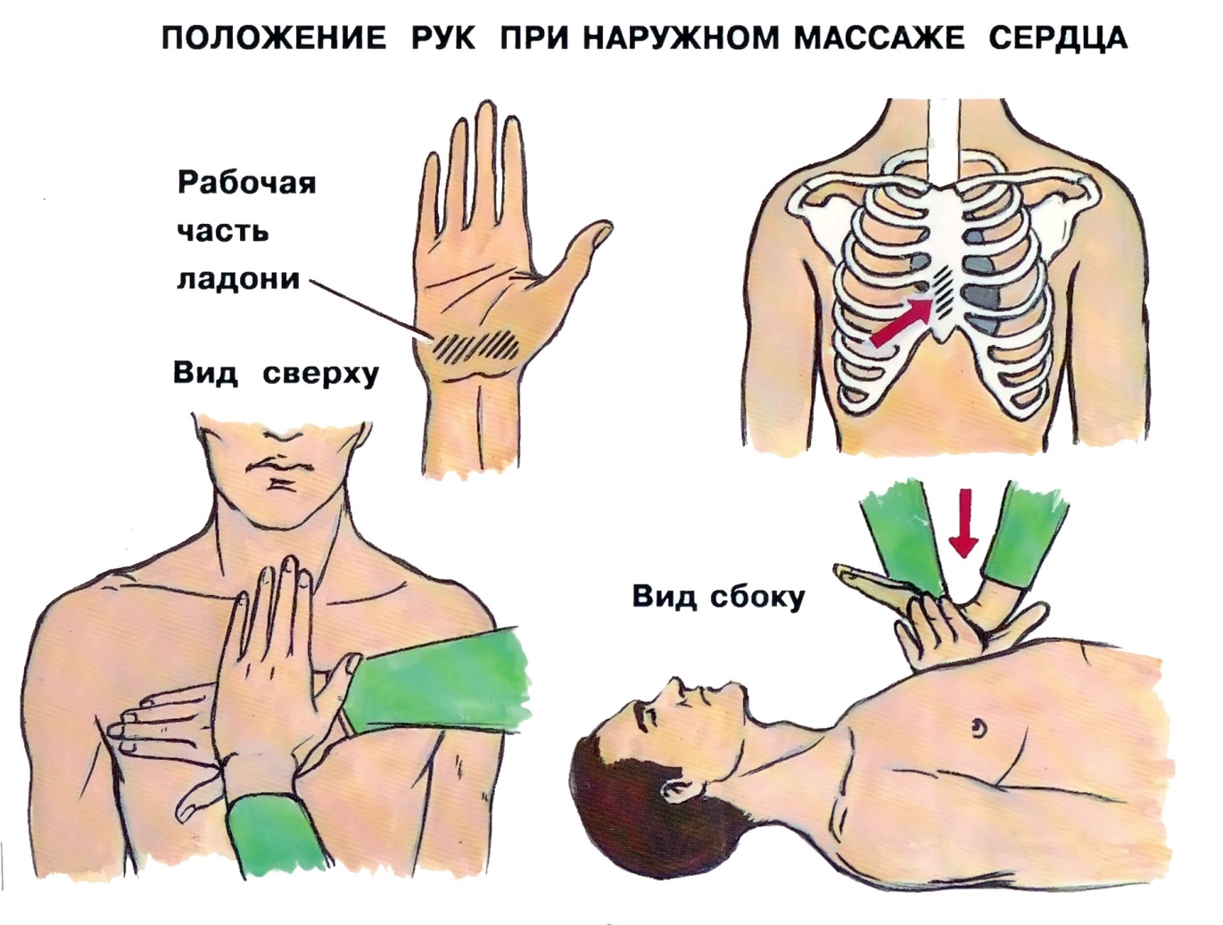 Местоположение рук. Расположение ладоней при сердечно легочной реанимации. Положение рук при массаже сердца. Расположение рук при непрямом массаже сердца. Наружный непрямой массаж сердца.