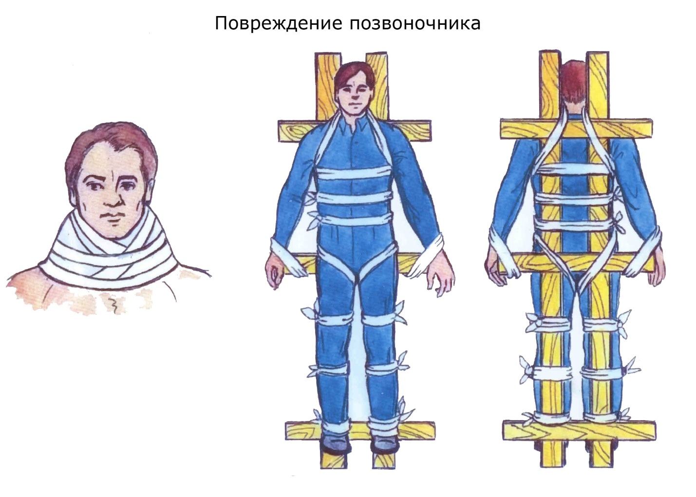 Шина при травме головы