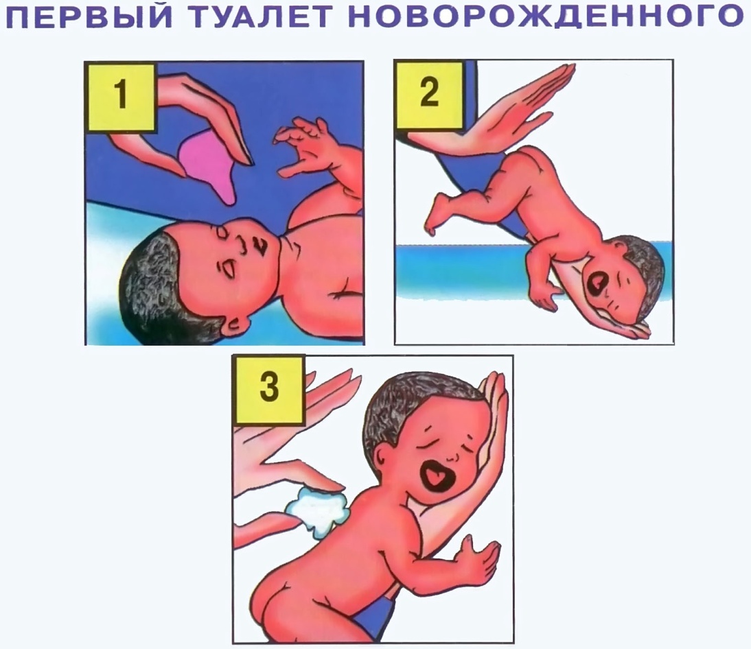 Первый туалет новорожденного. Первичный туалет новорожденного. Проведение первичного туалета новорожденного. Первый этап первичного туалета новорожденного.