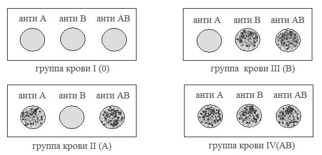 Алгоритм группы крови и резус фактора