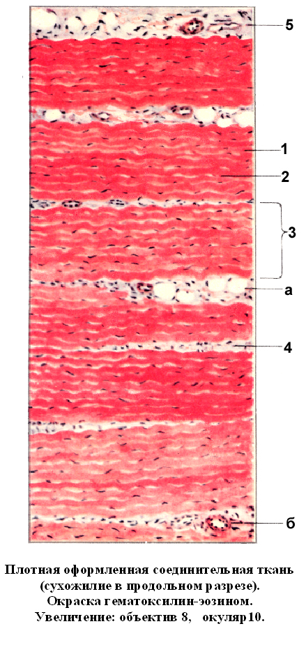 Сухожилия образованы из ткани. Плотная соединительная ткань гистология. Плотная оформленная соединительная ткань сухожилия препарат. Плотная оформленная соединительная ткань продольный срез сухожилия. Плотная оформленная соединительная ткань гистология.